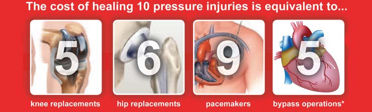 cost of healing pressure ulcers